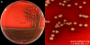 <strong>Fig. 121:1.</strong> Kolonier av <i>Streptococcus dysgalactiae</i> subsp. <i>equisimilis</i>, stam CCUG 36637, odlad aerobt på nötblodagar under 24 timmar vid 37 °C. Belysning kommer ovanifrån, men man kan ändå ana hemolysen (jfr. Fig. 121:2). B visar en närbild av plattan i A. Längden av hela skalstrecken motsvarar 10 och 3 mm i A resp. B. Datum: 2015-08-25. </p>