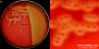 <p><strong>Fig. 121:2.</strong> Kolonier av <i>Streptococcus dysgalactiae</i> subsp. <i>equisimilis</i>, stam CCUG 36637, odlad aerobt på nötblodagar under 24 timmar vid 37 °C. Belysning kommer underifrån och man kan lätt se hemolysen (jfr. Fig. 121:1). B visar en närbild av plattan i A. Längden av hela skalstrecken motsvarar 10 och 3 mm i A resp. B. Datum: 2015-09-02.</p>

<p> </p>