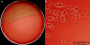 <strong>Fig. 226:2.</strong> Kolonier av <i>Staphylococcus schleiferi</i> subsp. <i>schleiferi</i>, stam CCUG 64084, odlad aerobt på nötblodagar under 24 timmar vid 37 °C. Belysning kommer huvudsakligen underifrån i och därför syns hemolysen tydligt (jfr. Fig. 226:1). A, översikt av hela agar plattan. B, delförstoring av kolonier. Datum: 2015-12-03.</p>