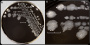<p><strong>Fig. 89:4.</strong> Kolonier av <em>Campylobacter jejuni</em> subsp. <em>jejuni</em> odlad mikroaerofilt på modifierad CCD-agar under 2 dygn vid 41,5 °C. Bild A visar hela plattan och bild B visar en delförstoring av några kolonier med typisk oregelbunden kant och metallglans. Längden på skalstrecken motsvarar 1 cm. Datum: 2017-02-09.</p>

<p> </p>