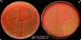 <p><strong>Fig. 147:1.</strong> Colonies of <i>Streptococcus suis</i>, cultivated on horse blood agar in 5% CO<sub><font size="2">2</font></sub> during 24 h at 37°C. Image A and B show an α-hemolysing strain of <em>S. suis </em>to the left and a ß-hemolysing strain of <em>S. suis </em>to the right<em>. </em>Image A is photographed with lighting from above and image B with lighting from below where the hemolysis is more easily observed. See also Fig. 147:2. The length of the scale bar is equivalent to 1 cm. Date: 2018-06-14.</p>