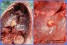 <p><strong>Fig. 10:9.</strong> Lung from foal suffering from <em>R. hoagii</em> infection (A) and close-up of an abscess<em>.</em> The pictures were taken in connection with autopsy, BVF, SLU. Date: 2020-12-10</p>