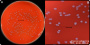 <p><strong>Fig 260:1.</strong> Colonies of <em>Enterococcus hirae</em>, cultured aerobically on bovine blood agar at 37°C during 24 h. The lengths of the scale bars in A and B are equivalent to 10 and 3 mm, respectively.</p>

<p>Date: 2023-01-26.</p>