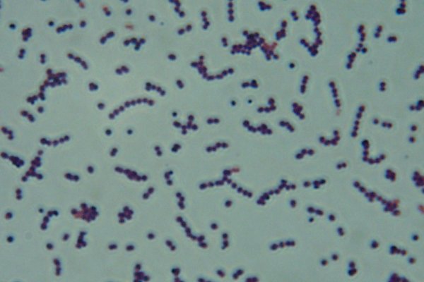 Streptococcus Equi Zooepidemicus Hyaluronic Acid