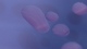 Rhodococcus equi