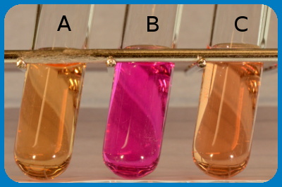 urea hydrolysis test