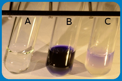 urea hydrolysis test