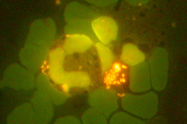 <i>Anaplasma phagocytophilum</i>