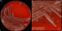 Bacteroides pyogenes